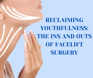 Reclaiming Youthfulness: The Ins and Outs of Facelift Surgery