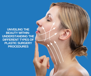 Unveiling the Beauty WithiN Understanding the Different Types of Plastic Surgery ProcedureS